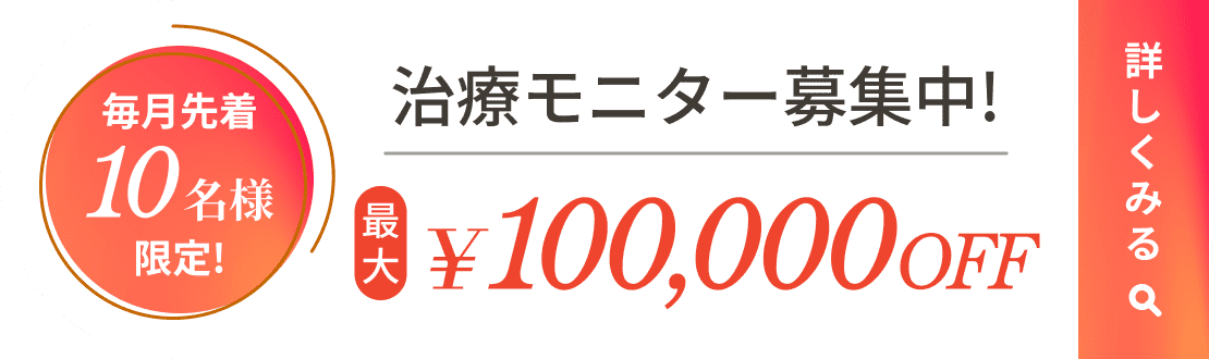 治療モニター募集中! 最大100,000円OFF